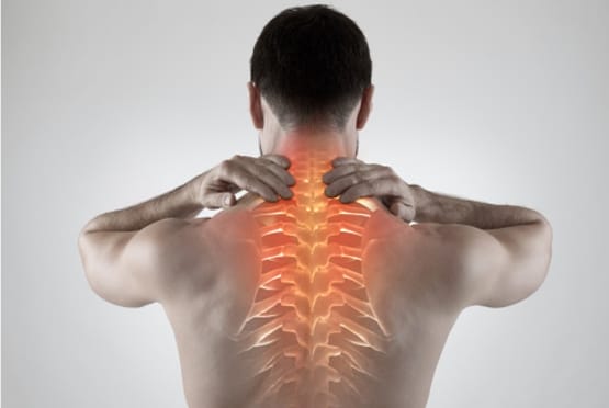 Cervical Spondylosis